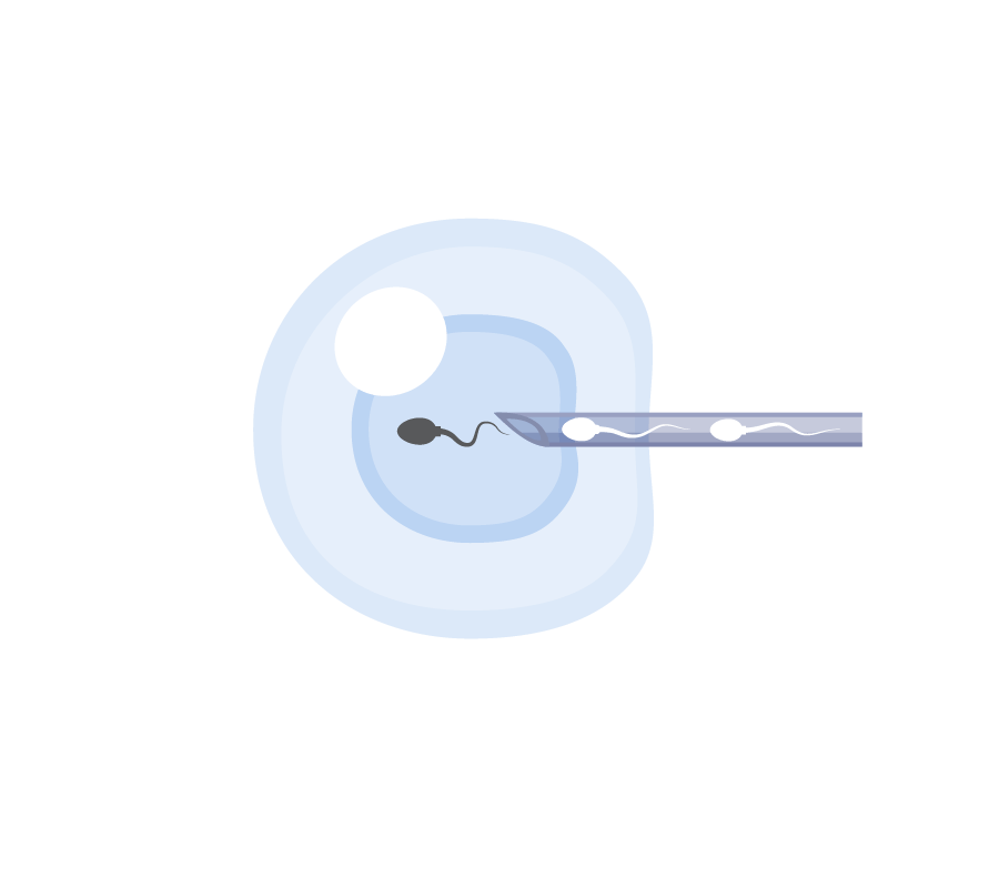 ivf-01
